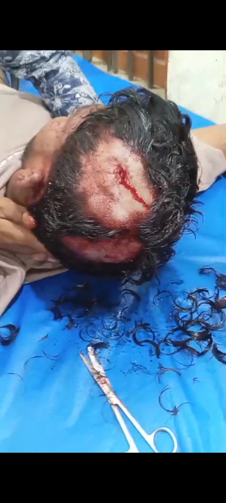পাকুন্দিয়ায় তারাবীর নামাজের সময় যুবককে কুপিয়ে আহত-