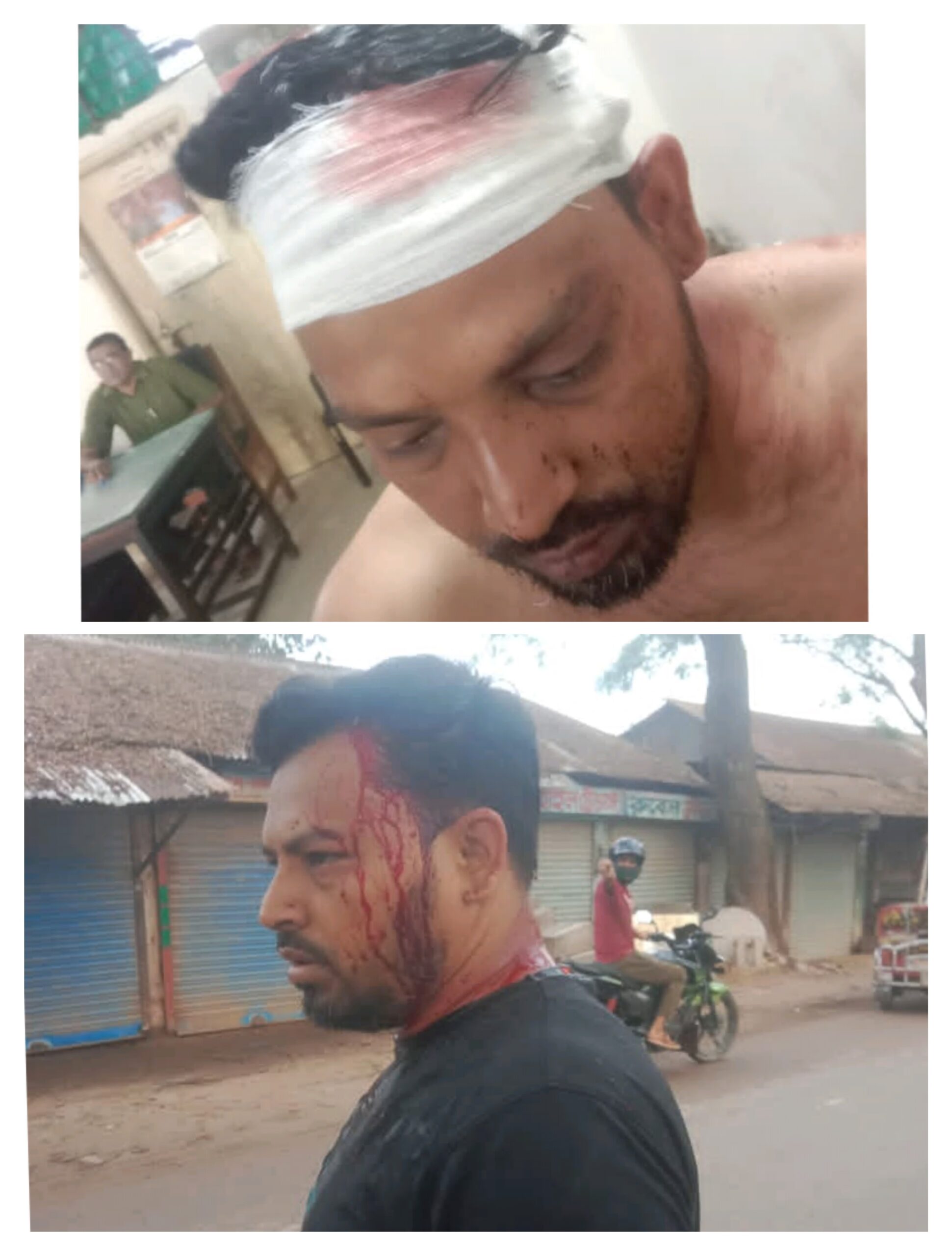 মুরাদনগরে কিশোরীকে অপহরণের চেষ্টা, বাধাঁ দেয়ায় মামাকে মারধর