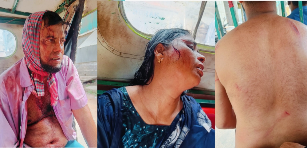 মুরাদনগরে সম্পত্তি দখল নিয়ে রক্তক্ষয়ী সংঘর্ষ, নারীসহ আহত-৪, আটক-১